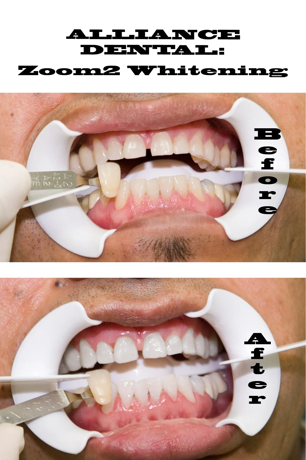 29789 teeth whitening queens ny 6