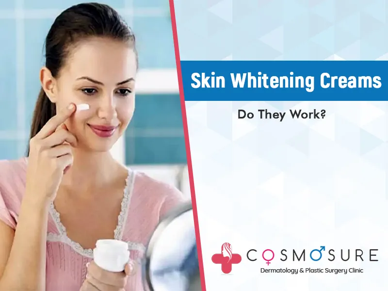 /img/29792-skin-whitening-cream-hyderabad-6.webp