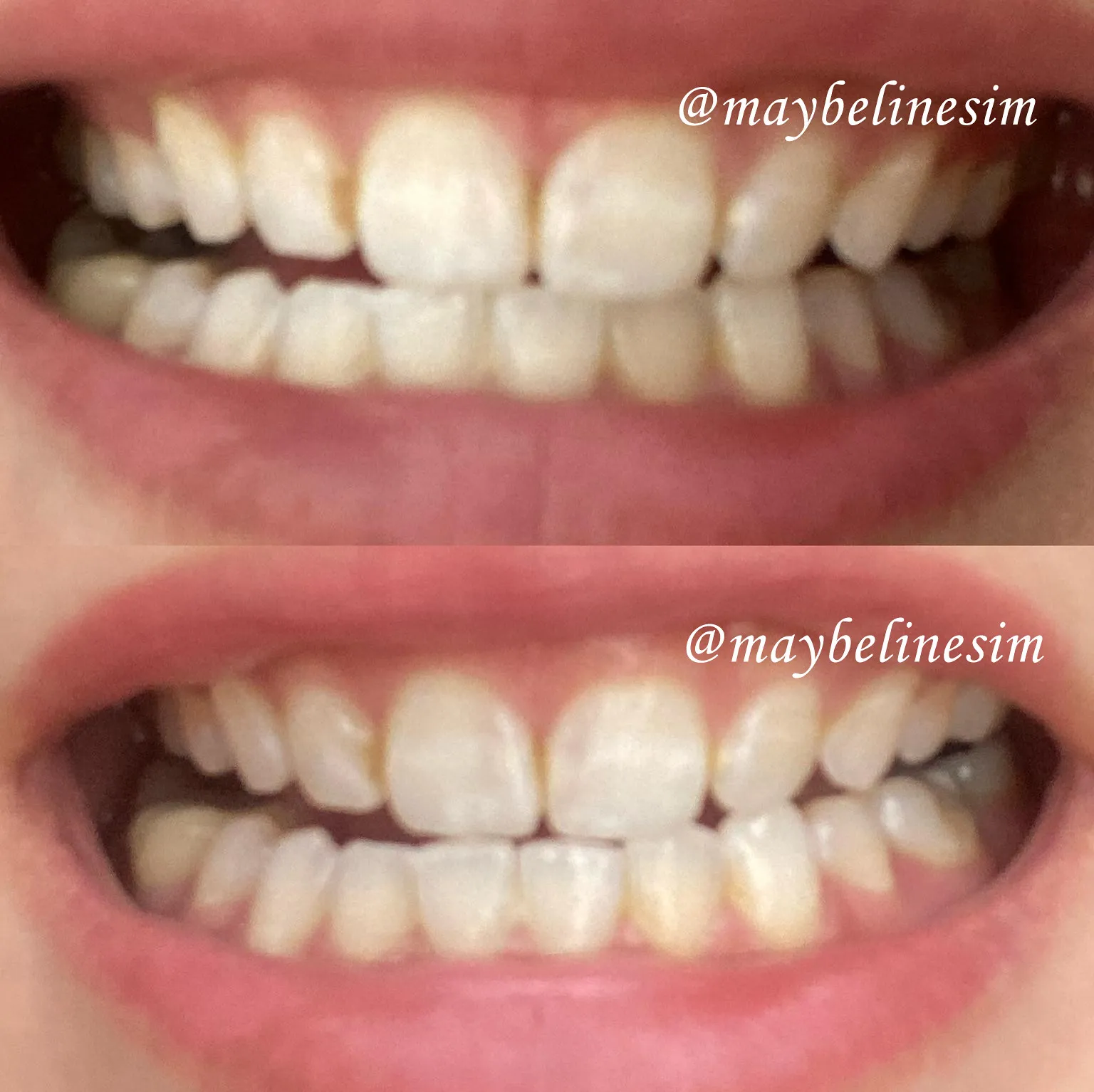 29795 daily oral hygiene