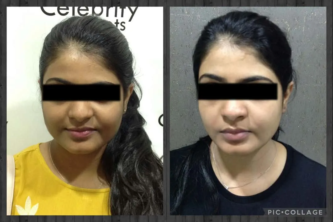 29799 whitening injection doctor