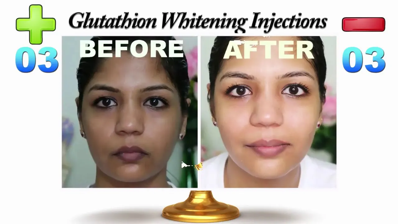 /img/29799-whitening-injection-results.webp