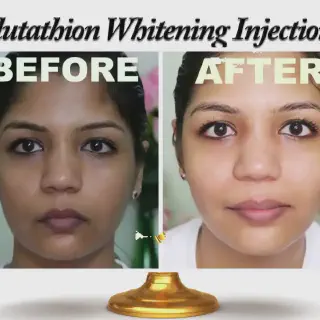 /img/29799-whitening-injection-results.webp
