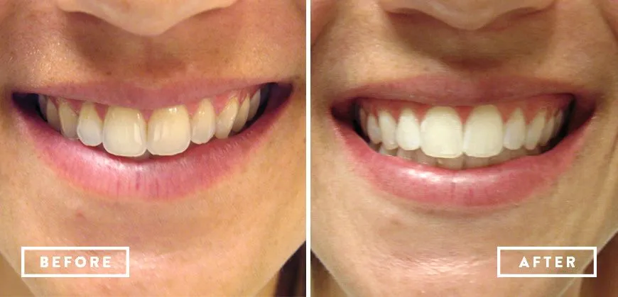 29802 dental checkup