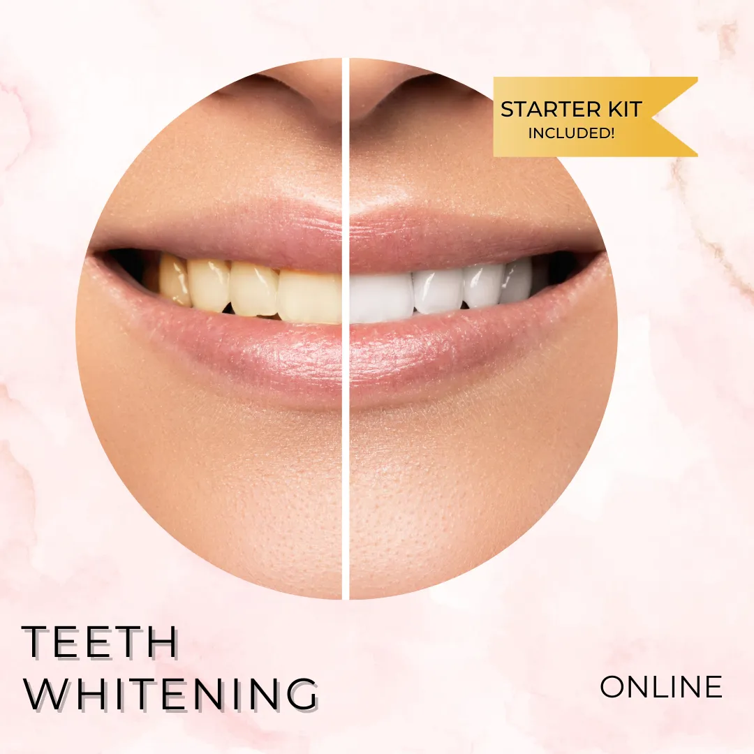 29804 teeth whitening before after