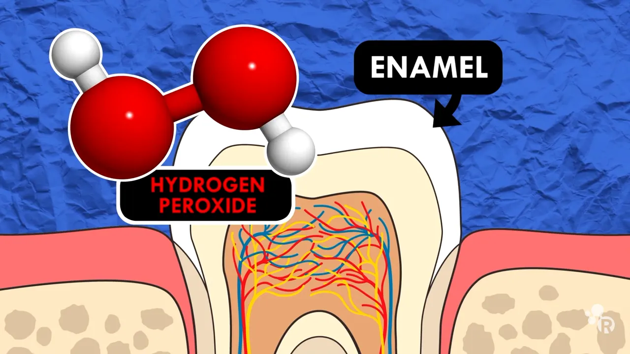29807 hydrogen peroxide teeth