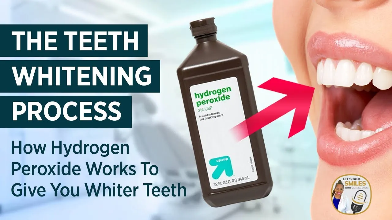 29810 teeth whitening alternatives
