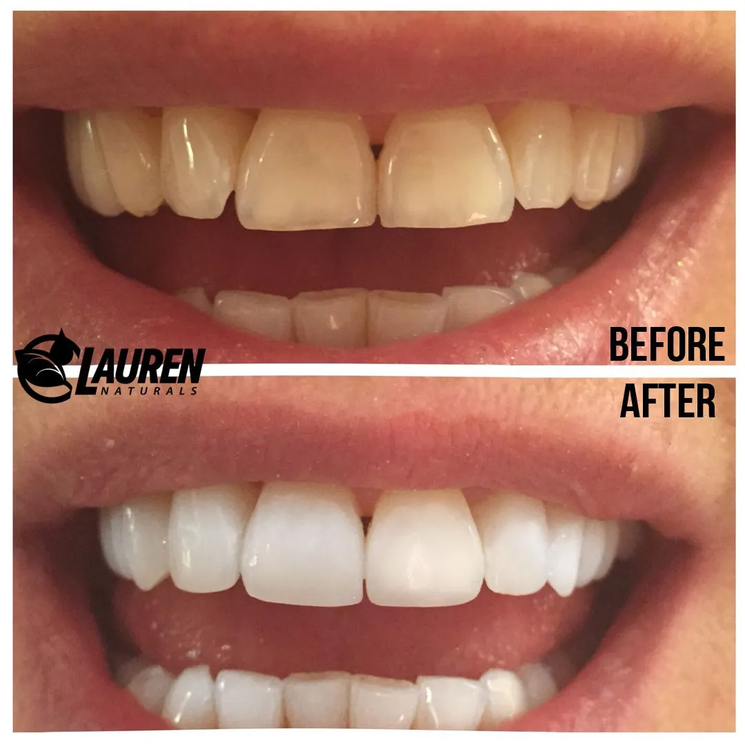 29812 oil pulling step3