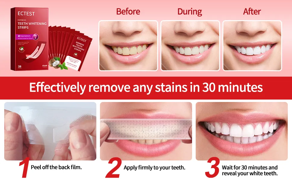 29815 opalescence whitening strips