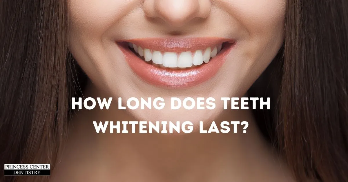 29819 teeth whitening toothpaste