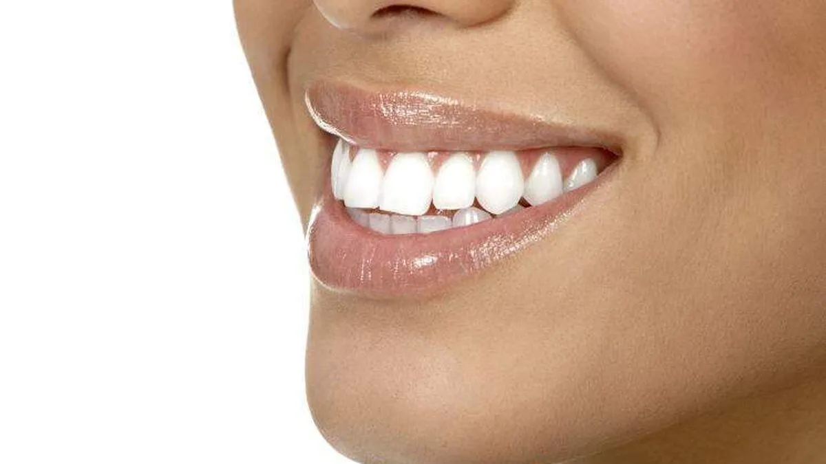29833 teeth whitening