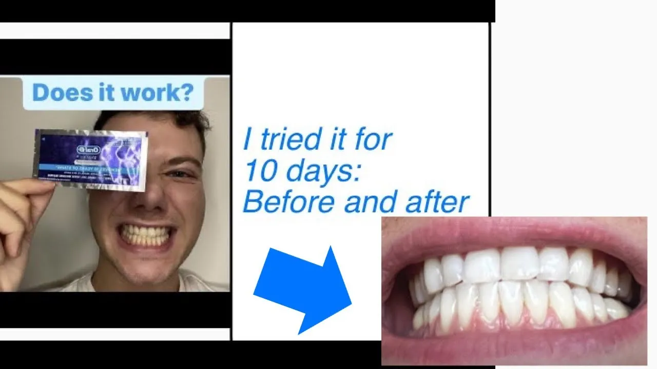 29839 applying oralb strips