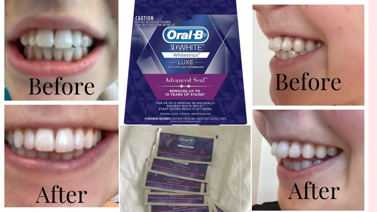 29839 oralb strips package