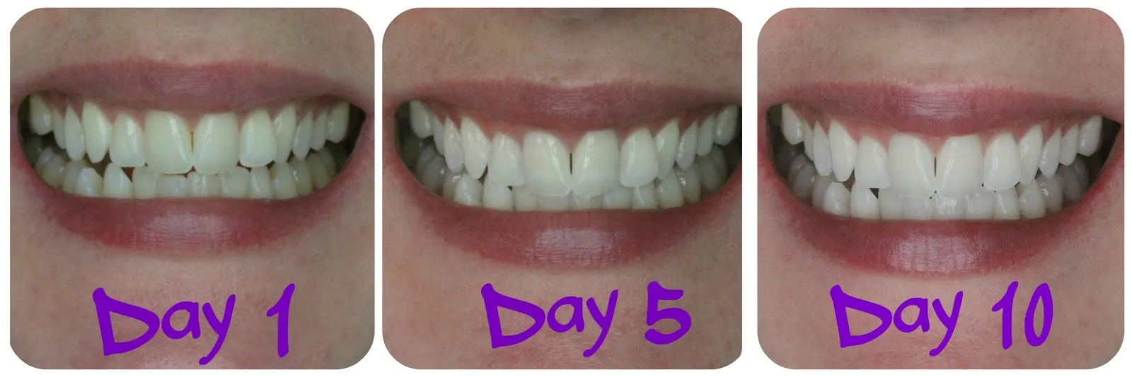 29839 sensitive teeth care