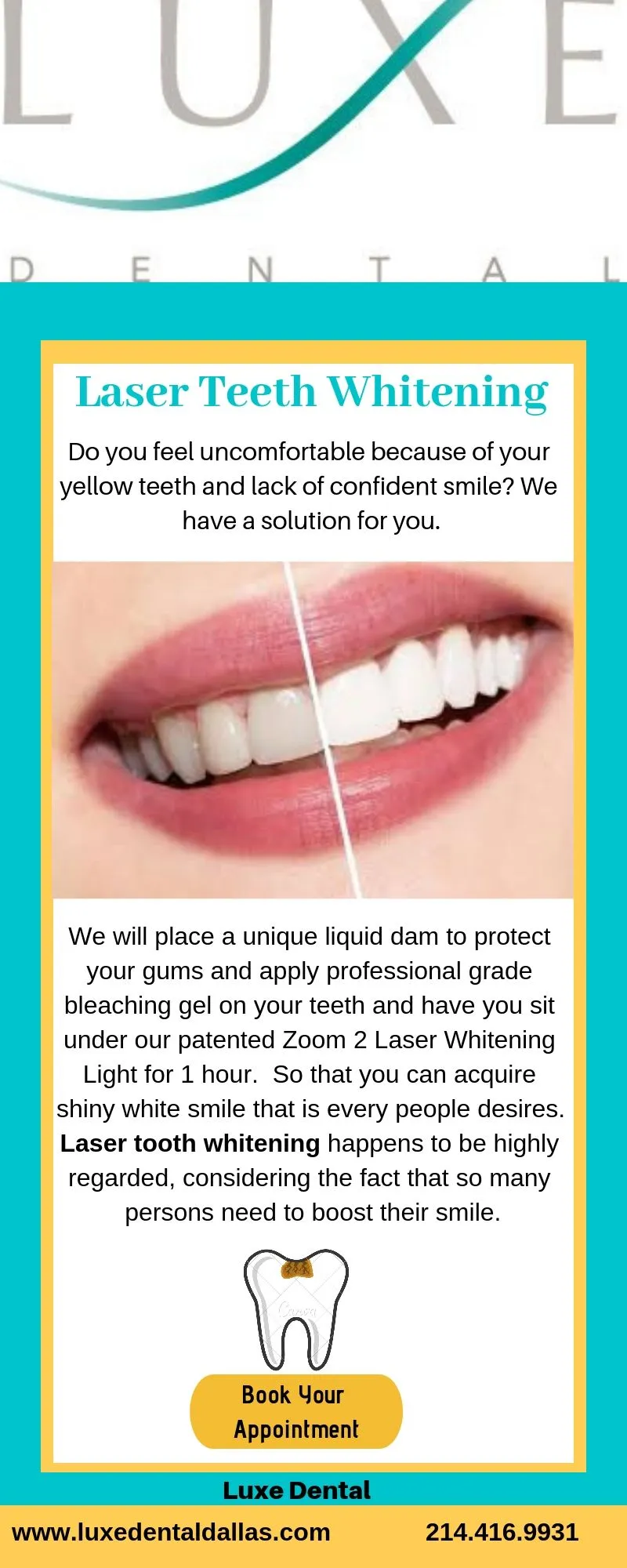 29850 teeth whitening insurance cover 5