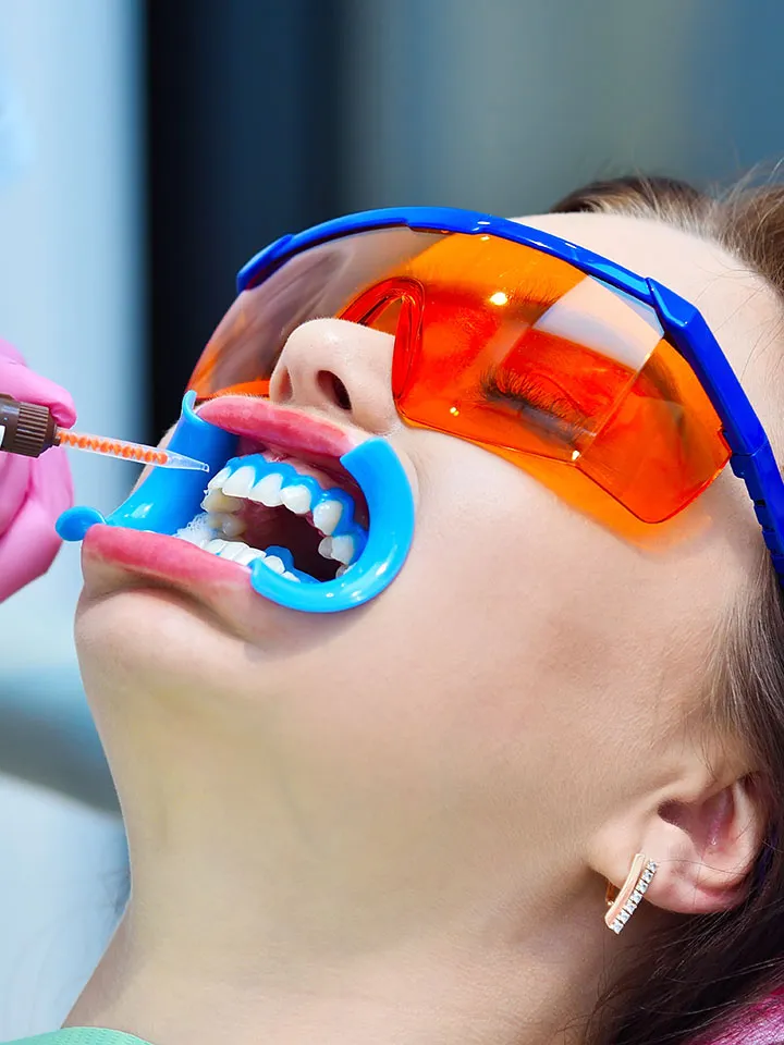 29852 teeth whitening 6