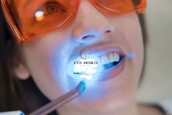 29853 sensitive teeth tips