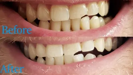 29854 drinks to avoid