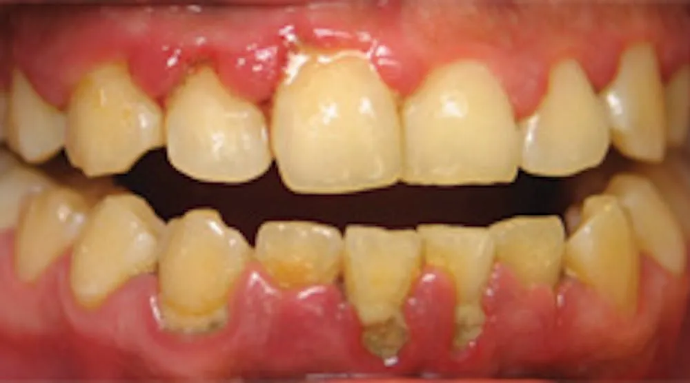 29857 dental checkup