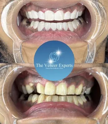 29860 teeth whitening rockford il image3