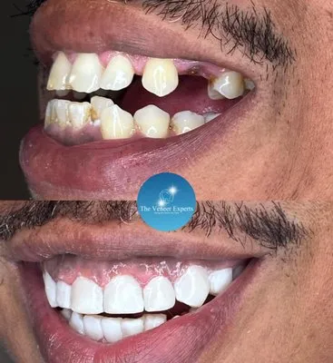 29860 teeth whitening rockford il image6