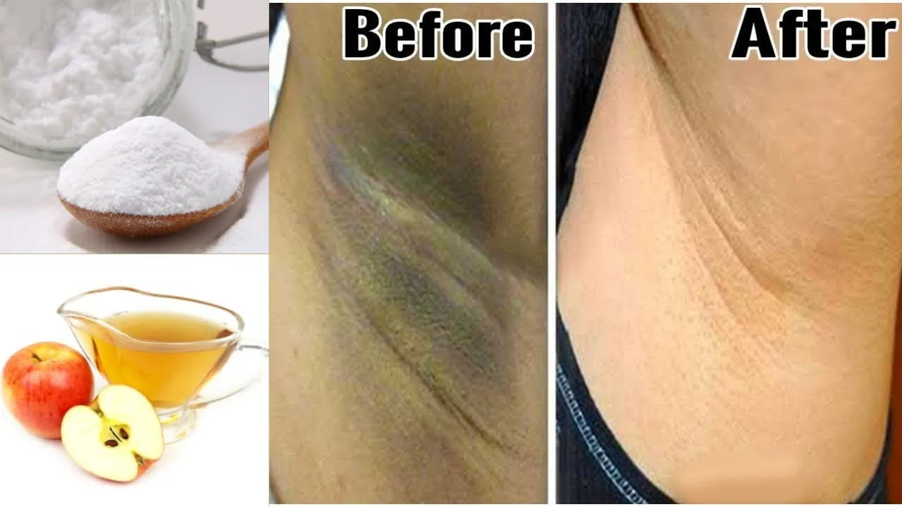 29862 underarm whitening moisturizing