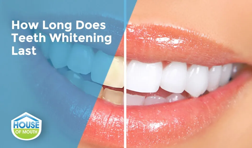 29865 teeth whitening sensitivity 6