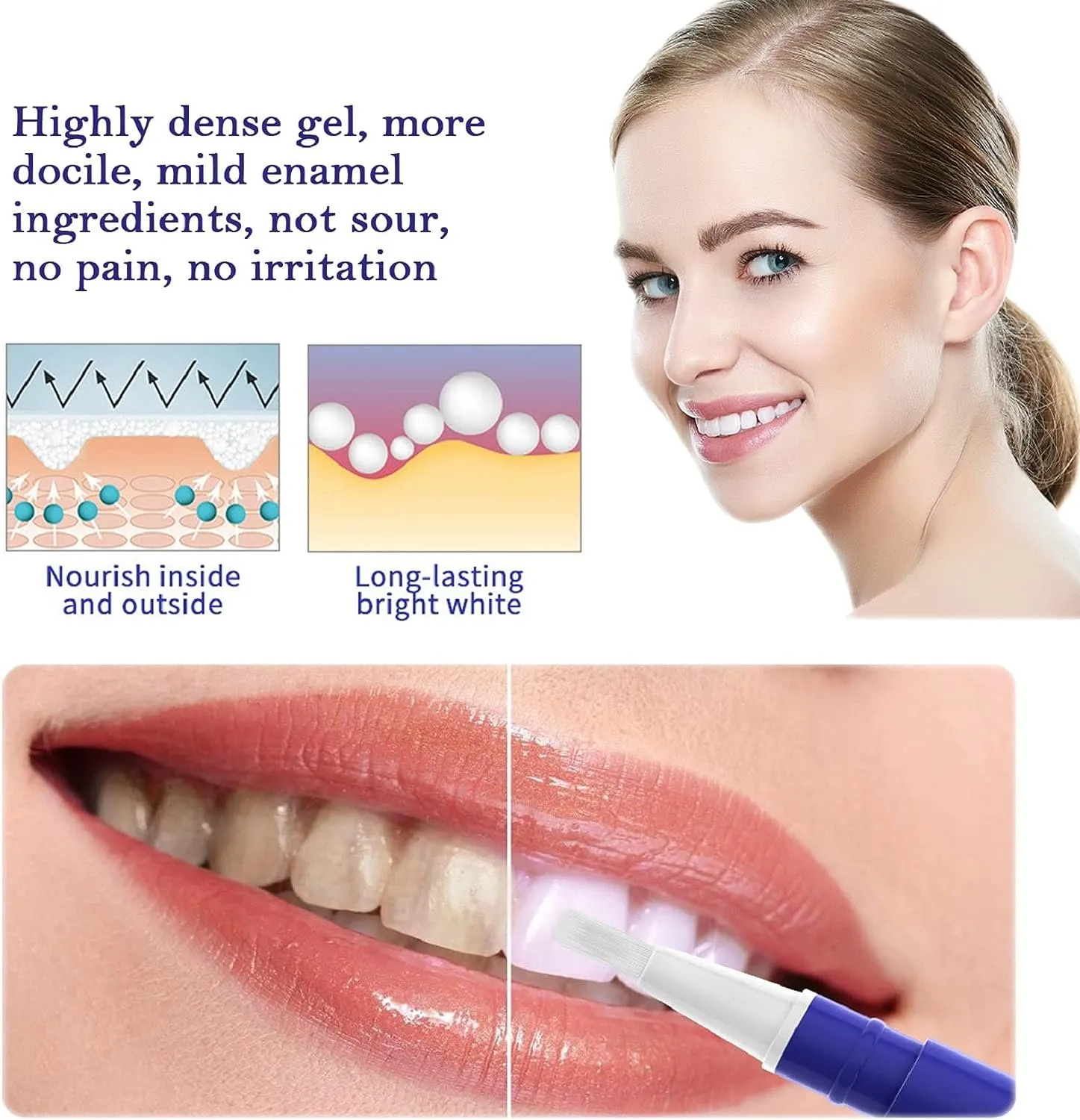29866 teeth whitening pen results