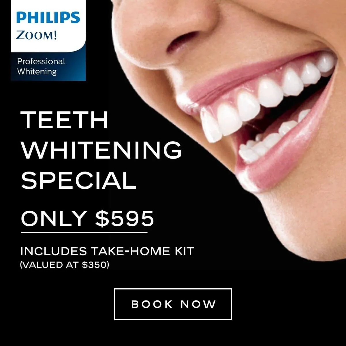 29868 zoom teeth whitening sydney dentist