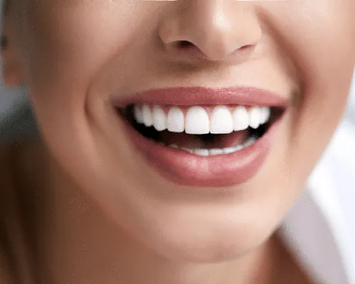 29868 zoom teeth whitening sydney sensitivity