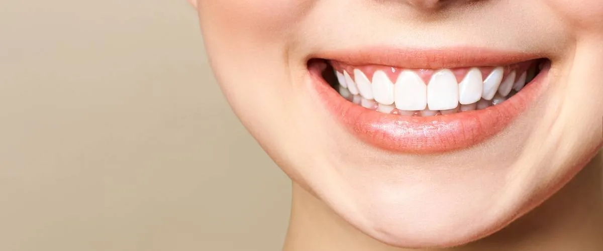29869 teeth whitening norwood procedure