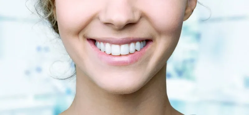 29869 teeth whitening norwood professional