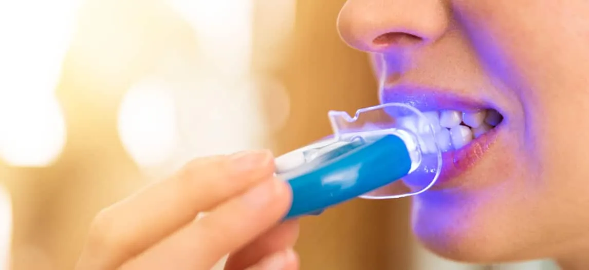 29870 teeth whitening kit ingredients