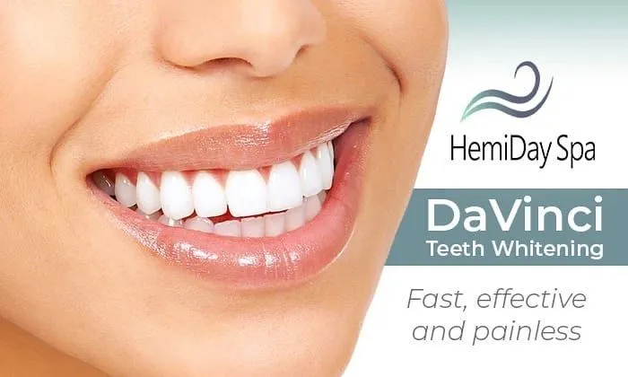 29871 davinci teeth whitening flatirons mall dentist examining