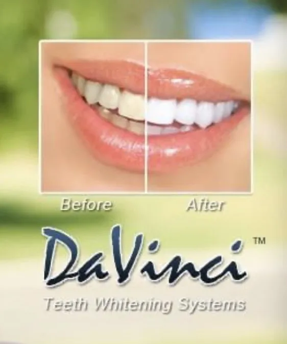 29871 davinci teeth whitening flatirons mall treatment room