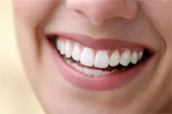 29878 zoom teeth whitening utah healthy teeth