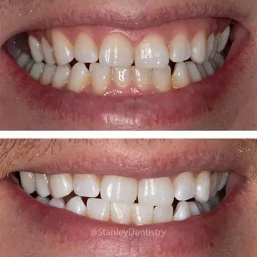 29882 whitening toothpaste