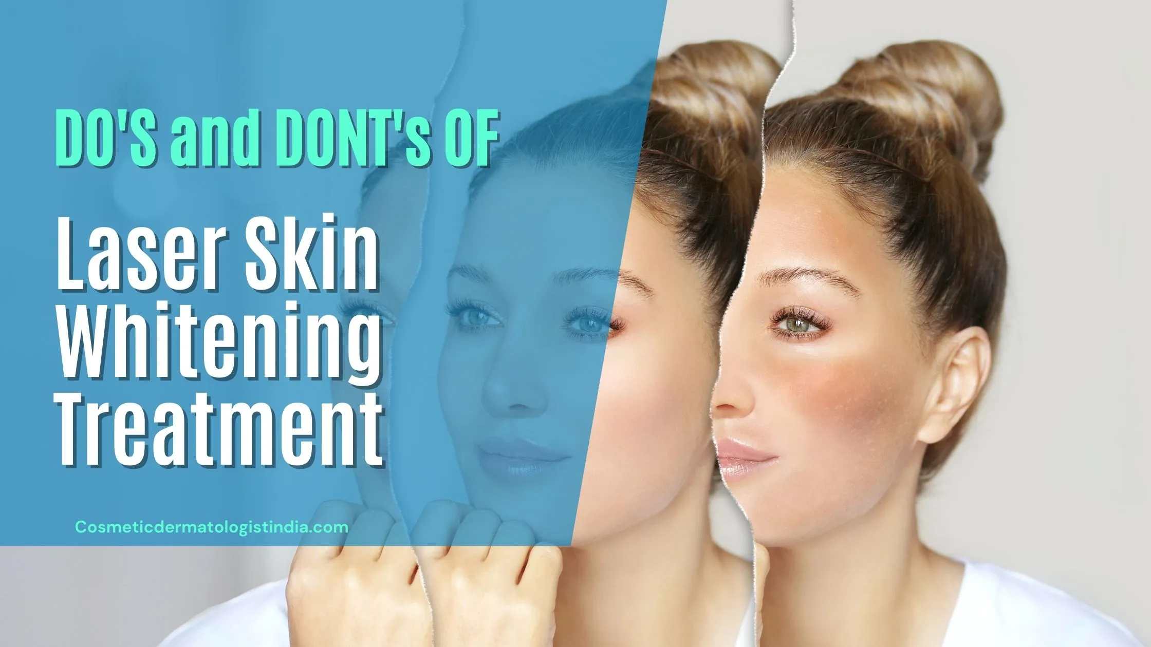 29896 skin whitening laser mumbai 2