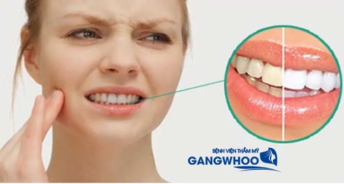 29898 dentist teeth whitening