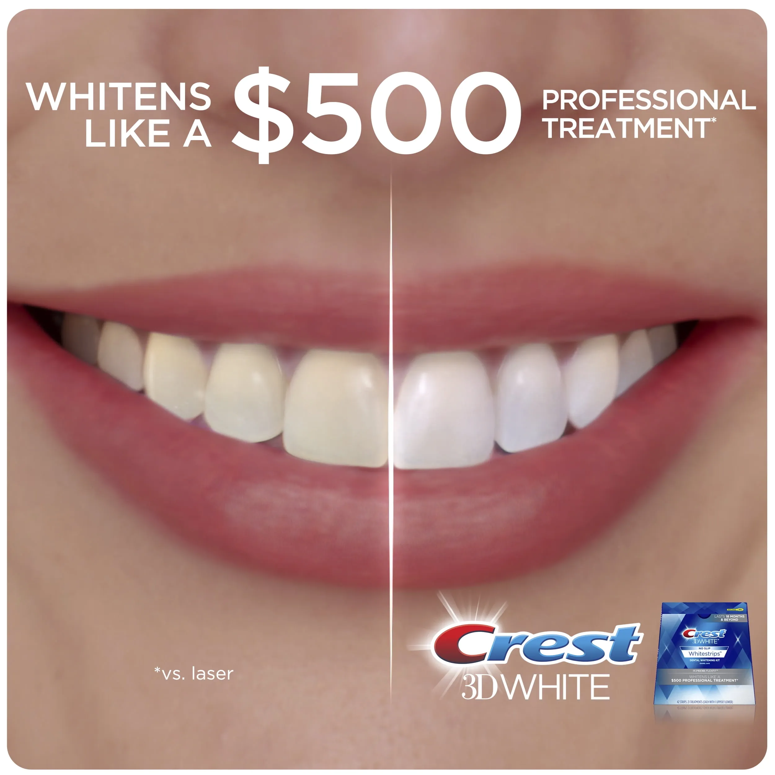 29899 teeth whitening alternatives
