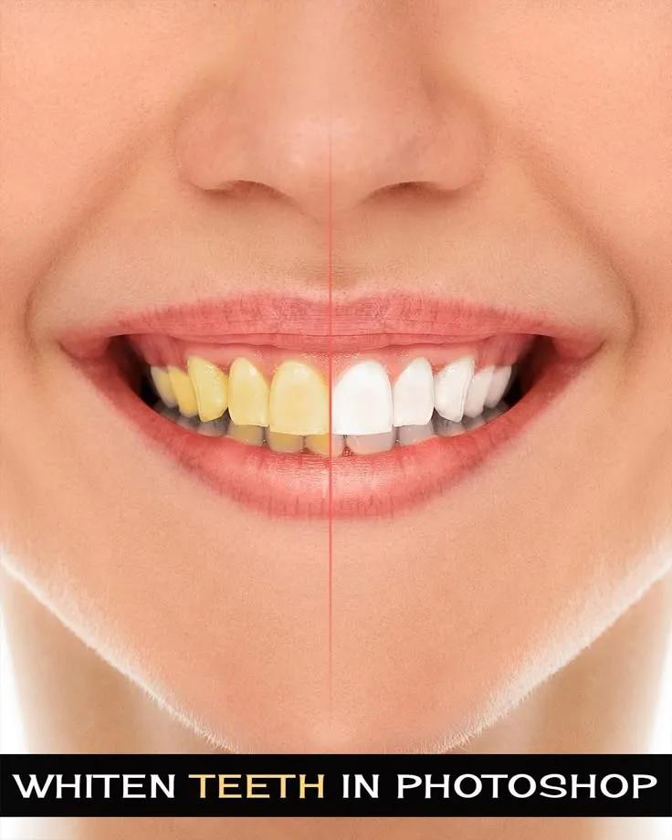 29903 teeth whitening tools