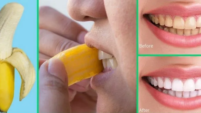 29906 banana peel science