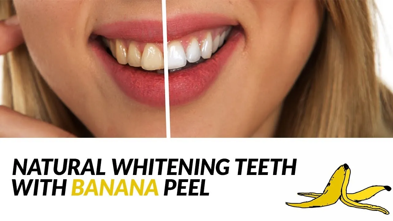 /img/29906-teeth-whitening-alternative.webp