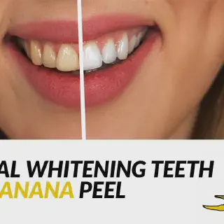 /img/29906-teeth-whitening-alternative.webp