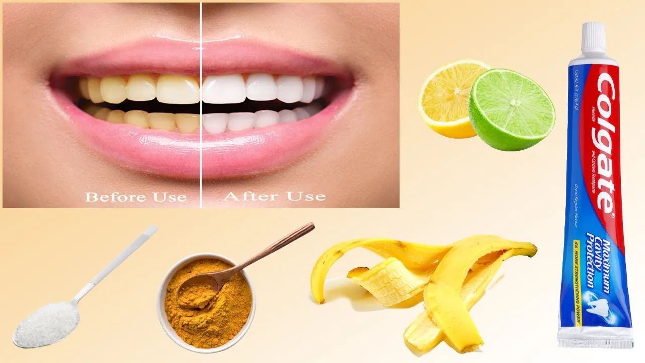 29906 teeth whitening effectiveness