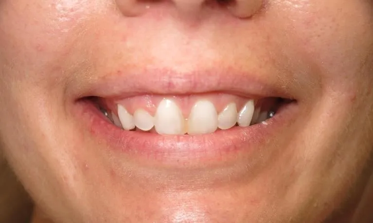 /img/29915-teeth-whitening-lake-charles-dental-clinic.webp