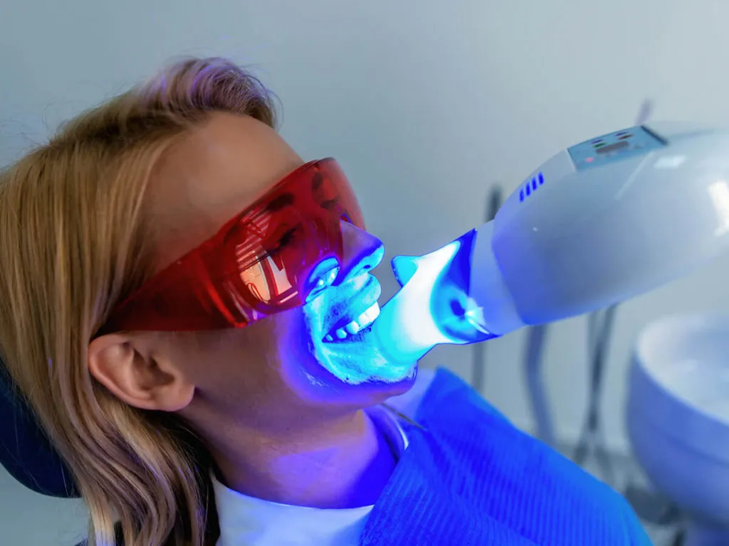 29936 teeth whitening procedure