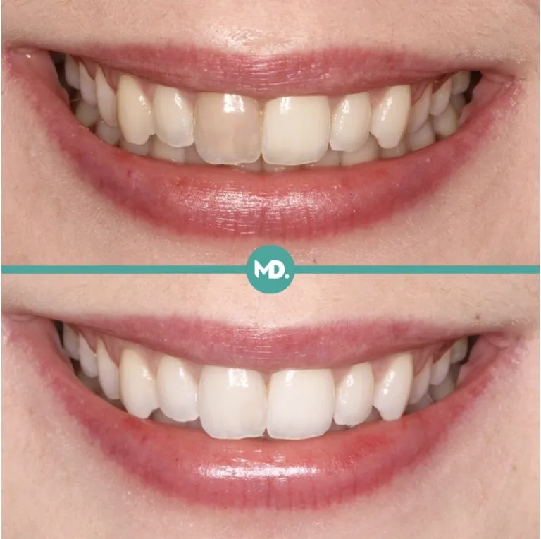 29937 dentist consultation