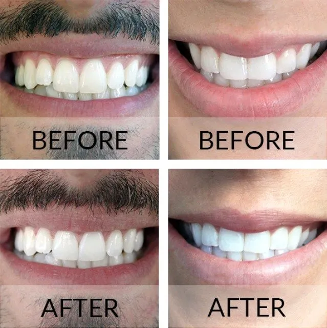 29937 healthy smile