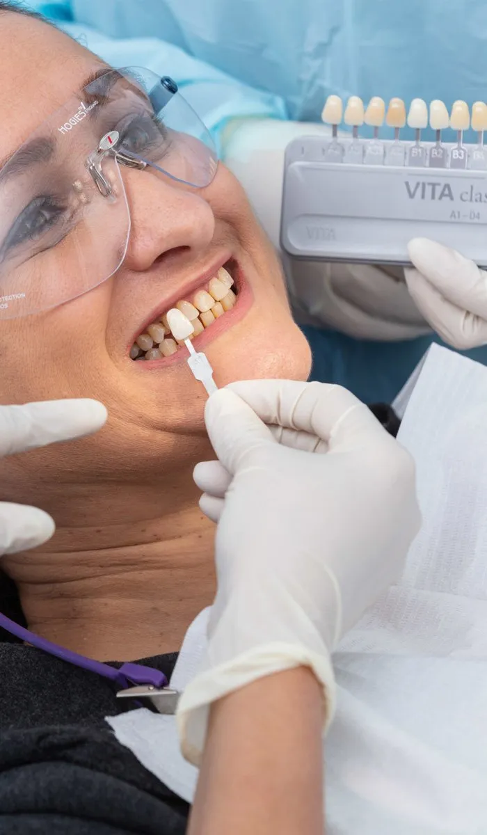 29937 teeth whitening custom tray