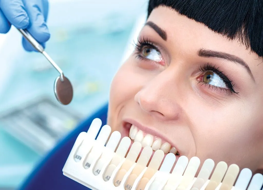 29938 in office teeth whitening